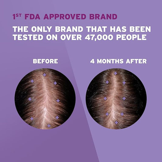 Rogaine Women's 2% Minoxidil Topical Solution for Womens Hair Thinning and Loss & Hair Regrowth