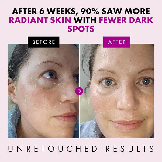 Eclat Collagen Anti Aging Face Cream with Patented Matrixyl-3000 & Argireline