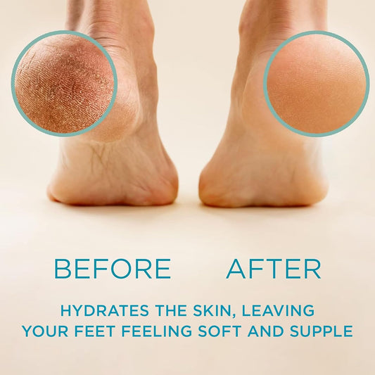 Lee Beauty Professional Callus Remover for Feet - Original