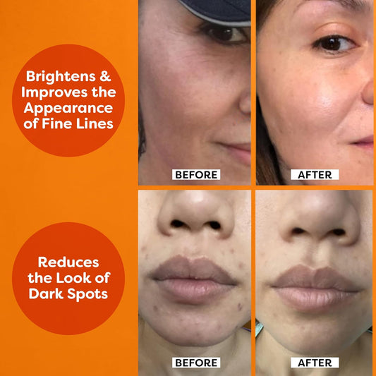 TruSkin Vitamin C Serum