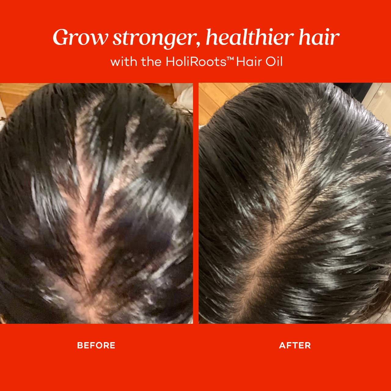 Fable & Mane HoliRoots™ Pre-Wash Treatment Oil for Thinning Hair 55ml