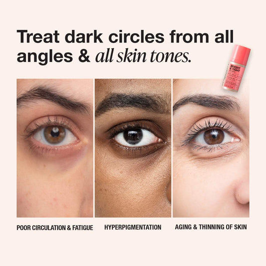 iNNBEAUTY PROJECT Bright & Tight Dark Circle Firming Eye Cream with Vitamin C & Peptides