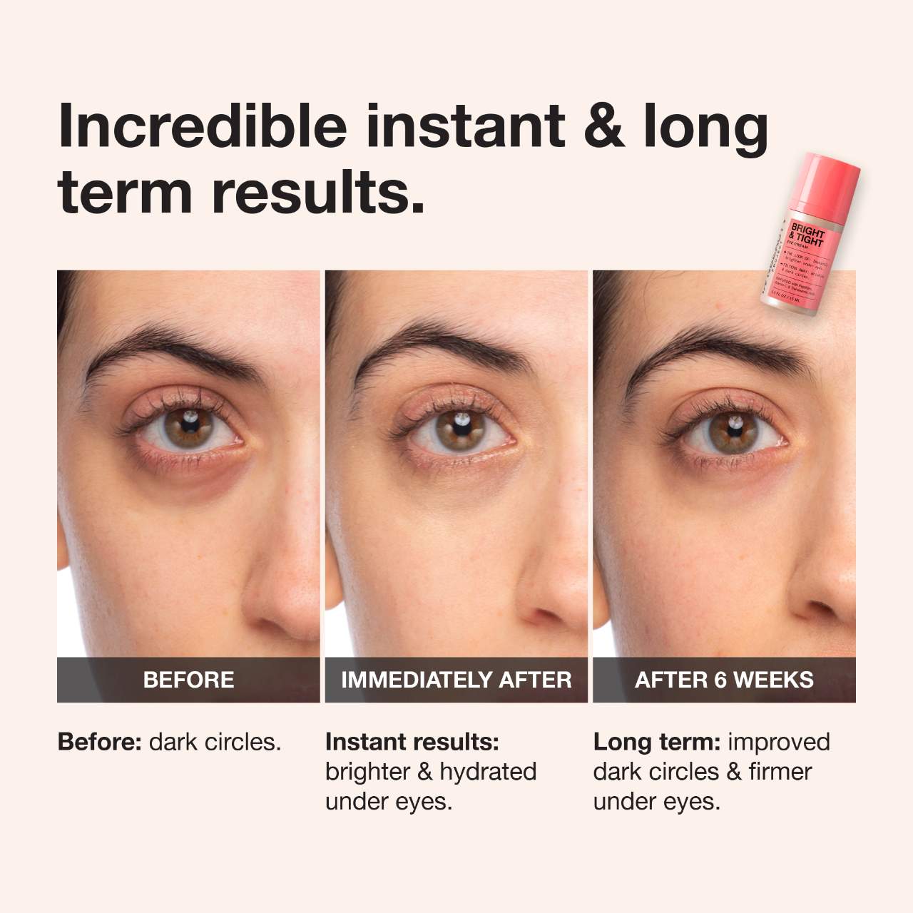 iNNBEAUTY PROJECT Bright & Tight Dark Circle Firming Eye Cream with Vitamin C & Peptides