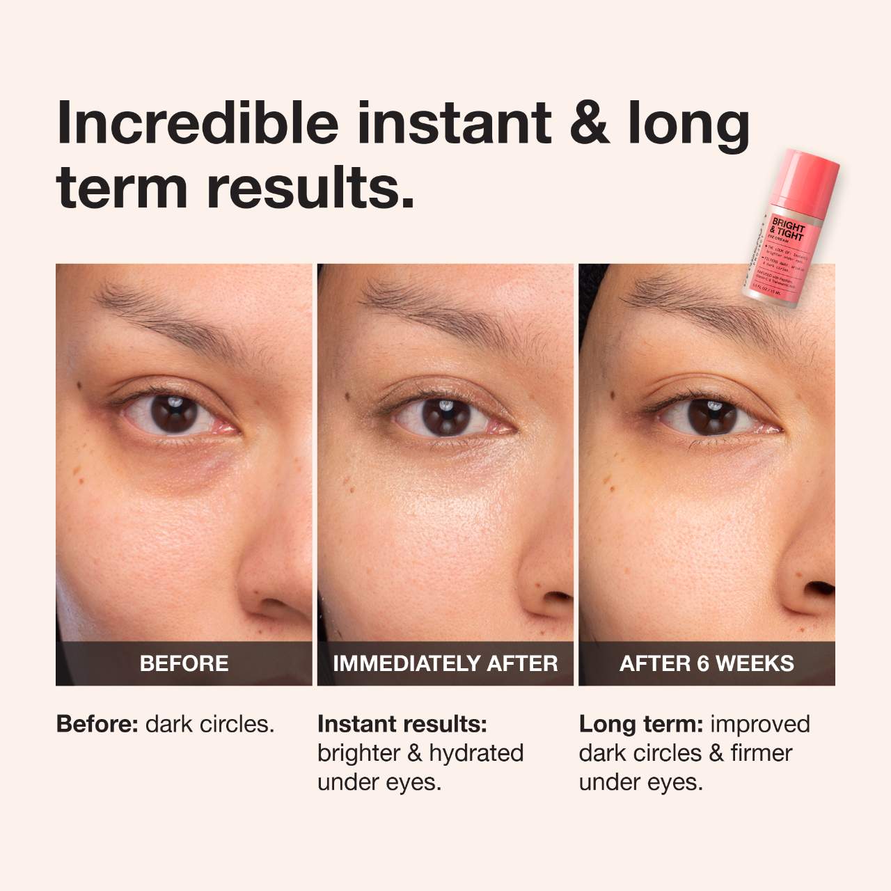 iNNBEAUTY PROJECT Bright & Tight Dark Circle Firming Eye Cream with Vitamin C & Peptides