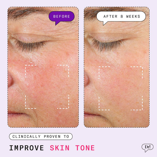 Dr. Idriss Major Fade Hyper Serum Dark Spot Treatment