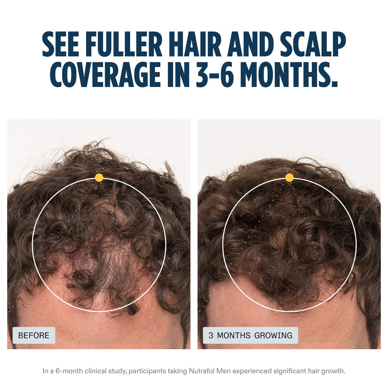 Nutrafol MEN Clinically Proven Hair Growth Supplement