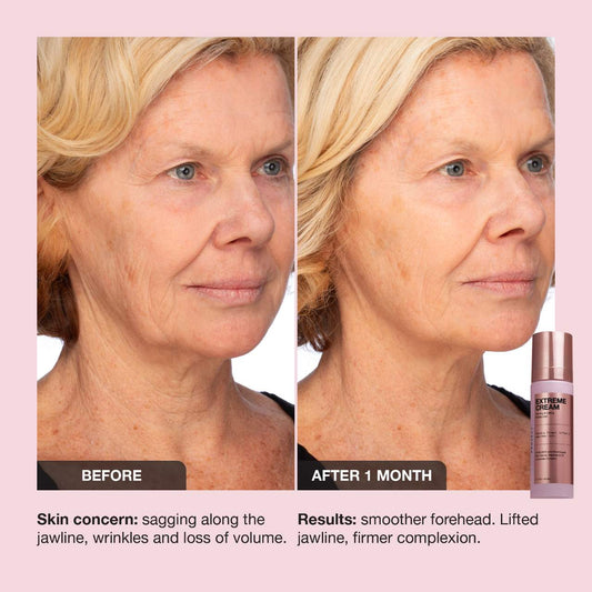 iNNBEAUTY PROJECT Extreme Cream Anti-Aging, Firming, & Lifting Refillable Moisturizer