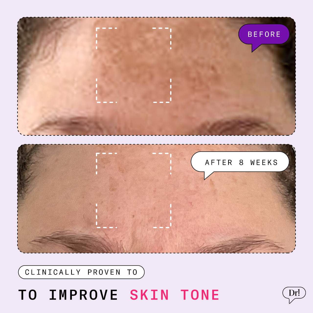 Dr. Idriss Major Fade Dark Spot Starter Kit