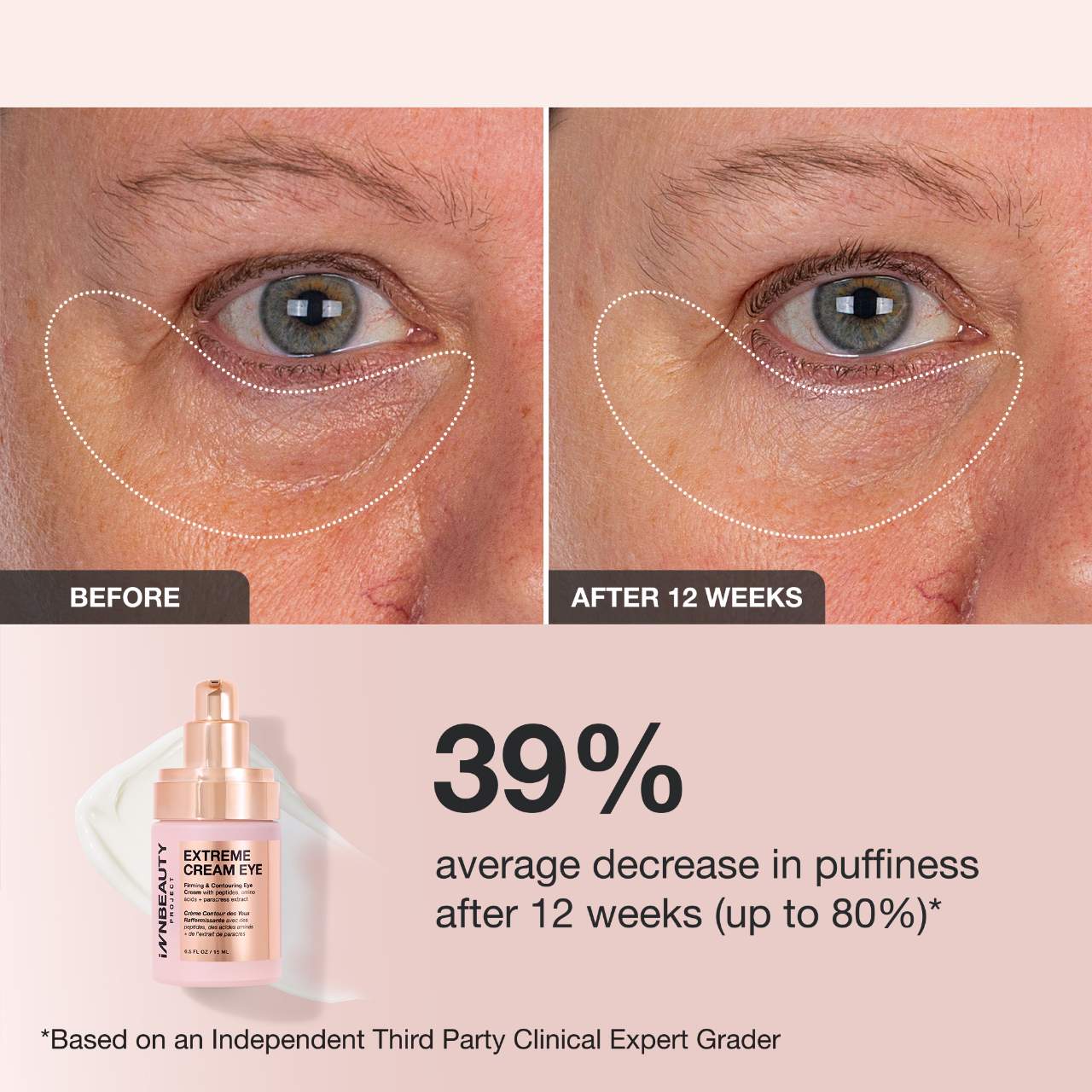 iNNBEAUTY PROJECT Extreme Cream Eye Firming & Contouring Refillable Eye Cream 15ml