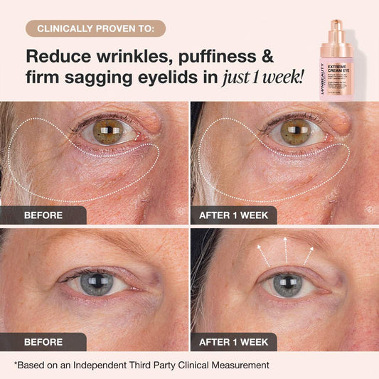 iNNBEAUTY PROJECT Extreme Cream Eye Firming & Contouring Refillable Eye Cream 15ml