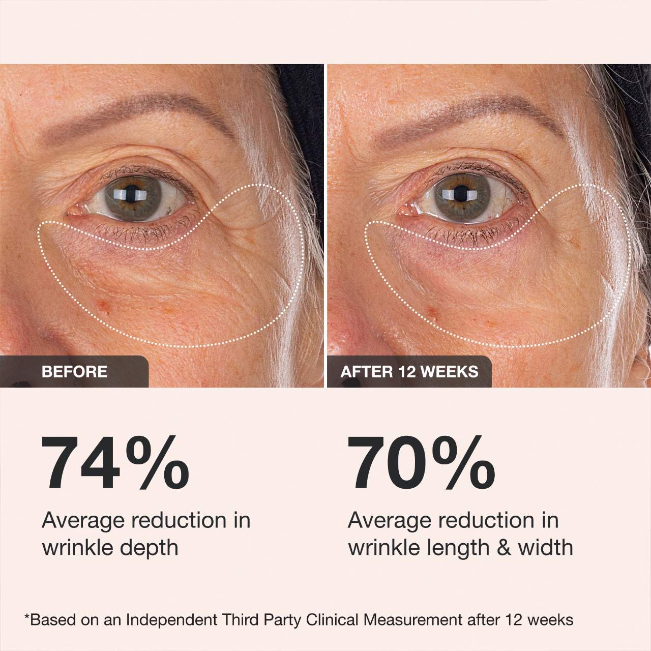iNNBEAUTY PROJECT Extreme Cream Eye Firming & Contouring Refillable Eye Cream 15ml