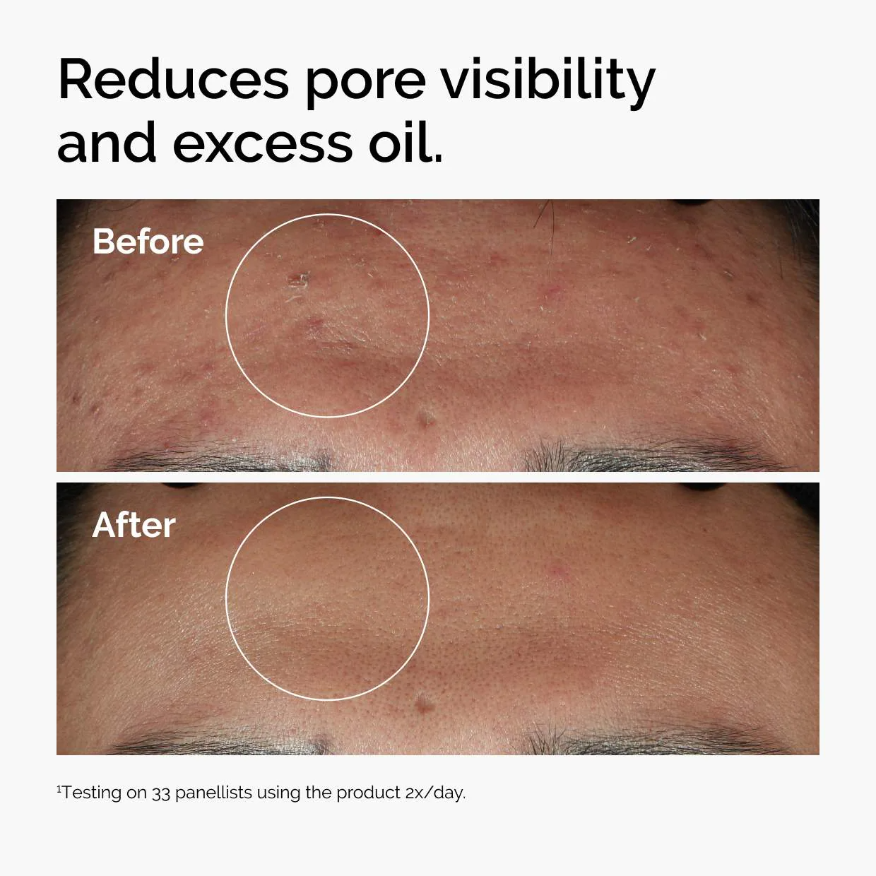 The Ordinary Niacinamide 10% + Zinc 1% Oil Control Serum