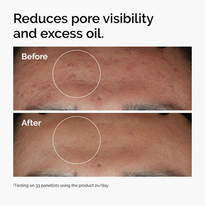 The Ordinary Niacinamide 10% + Zinc 1% Oil Control Serum