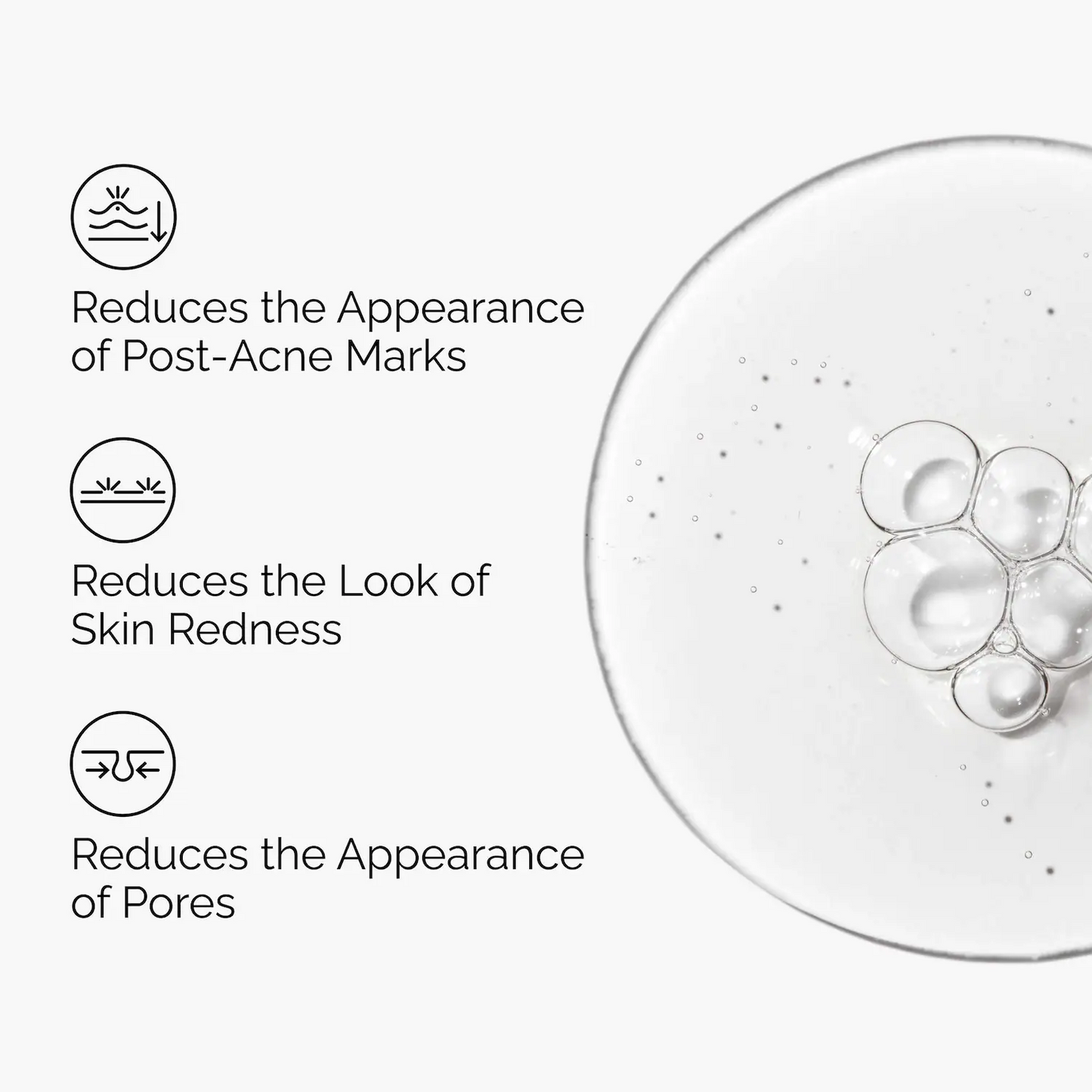 The Ordinary Aloe 2% + NAG 2% Solution
