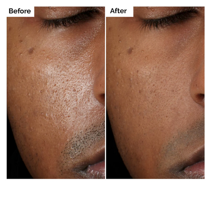 The Ordinary Aloe 2% + NAG 2% Solution