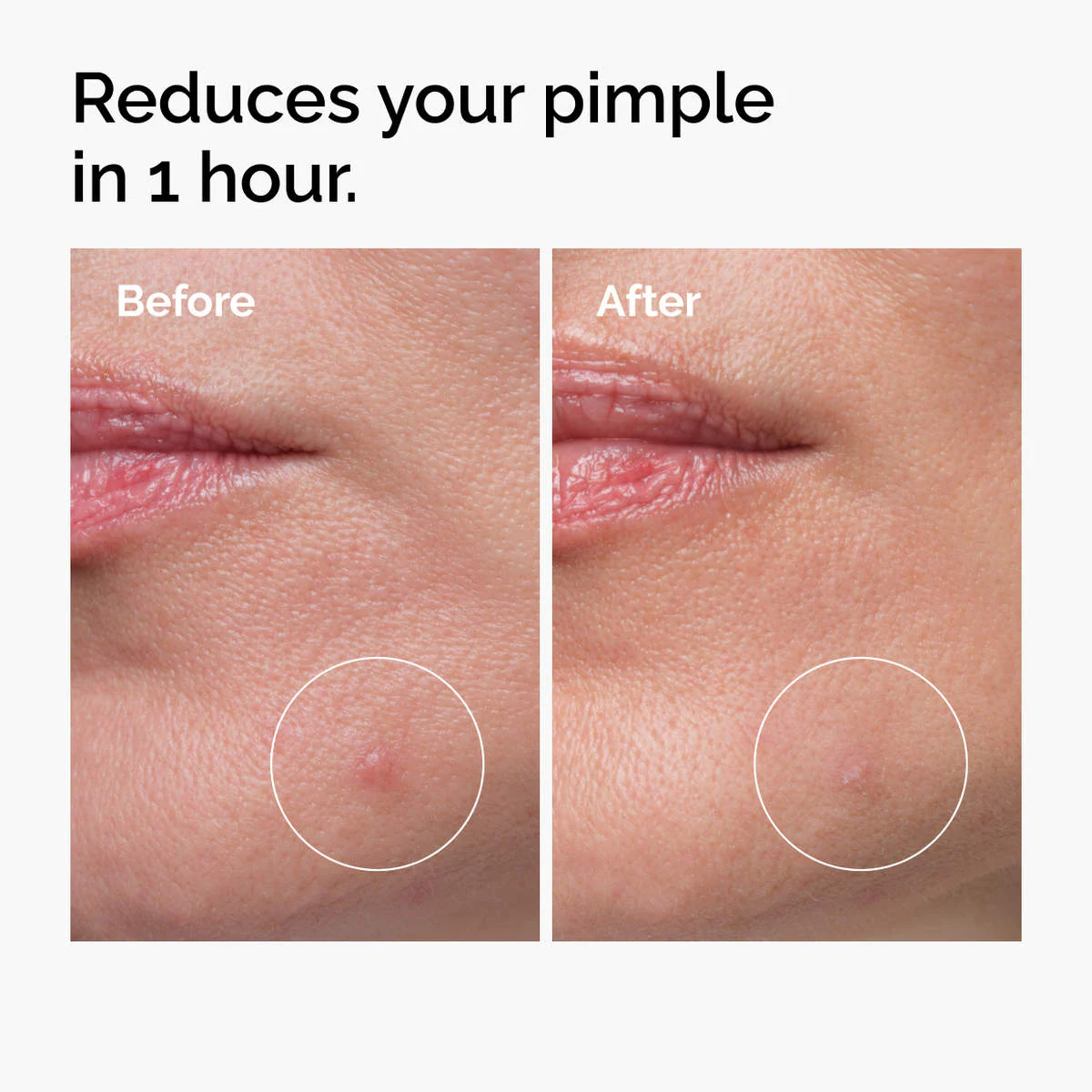 The Ordinary Sulfur 10% Powder-to-Cream Acne Spot Treatment