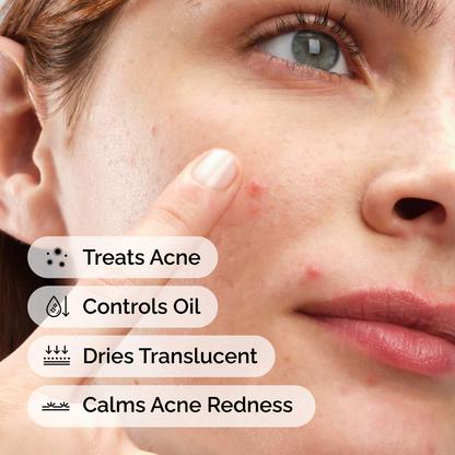 The Ordinary Sulfur 10% Powder-to-Cream Acne Spot Treatment