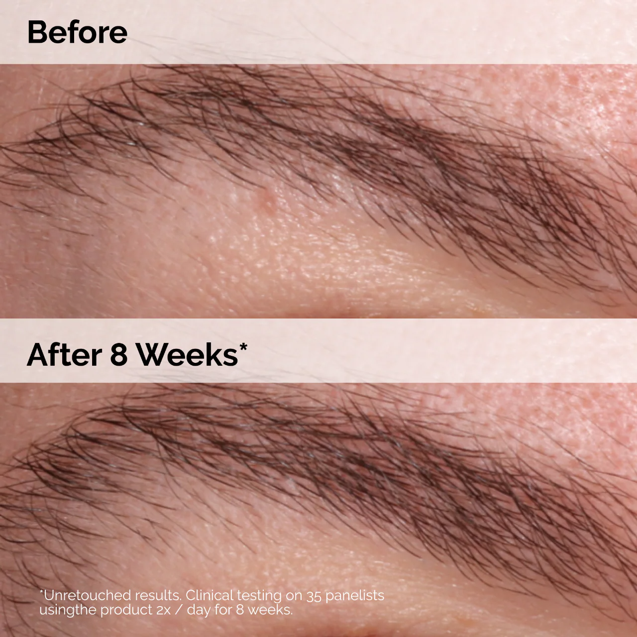 The Ordinary Multi-Peptide Lash & Brow Serum