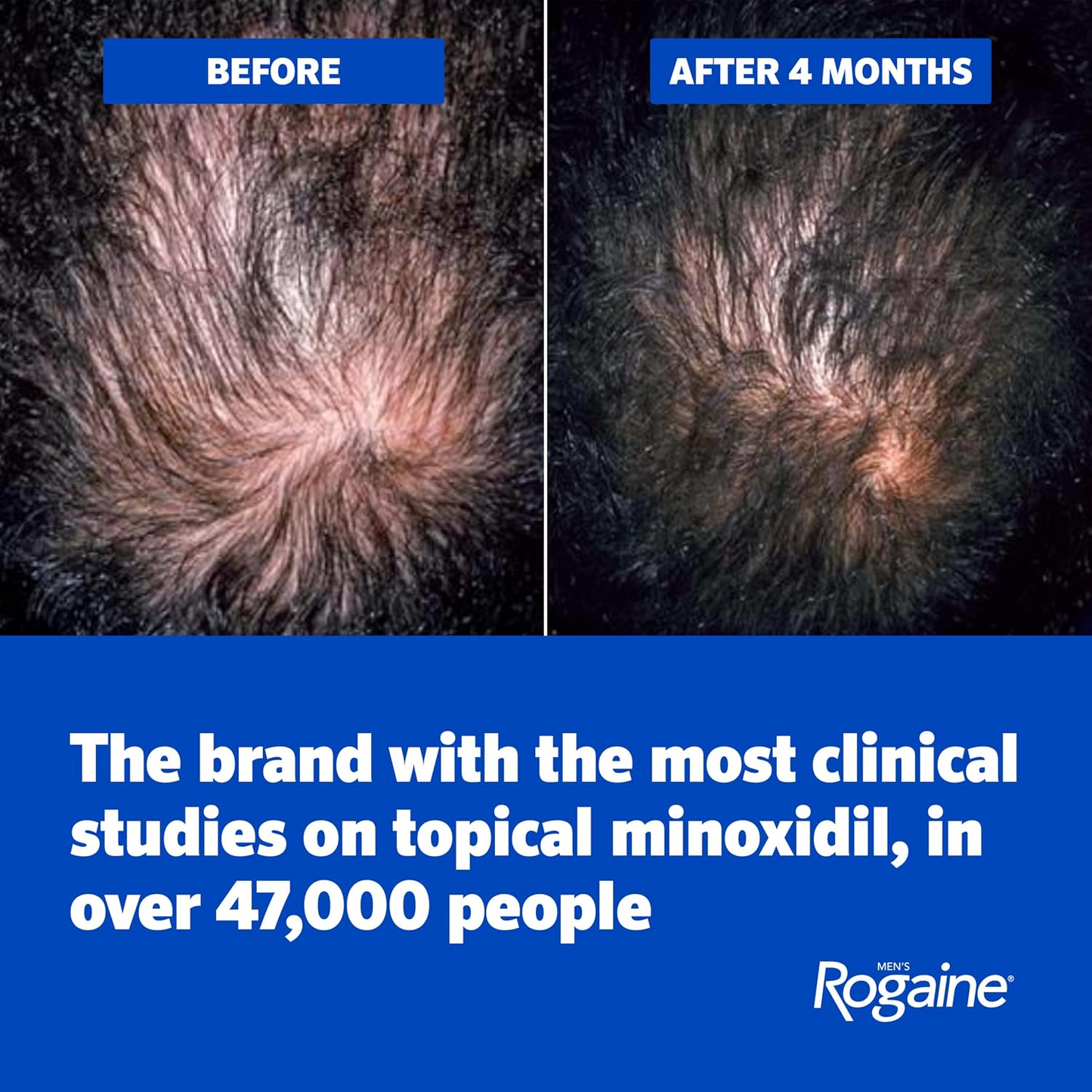 Rogaine Men's Extra Strength 5% Minoxidil Solution