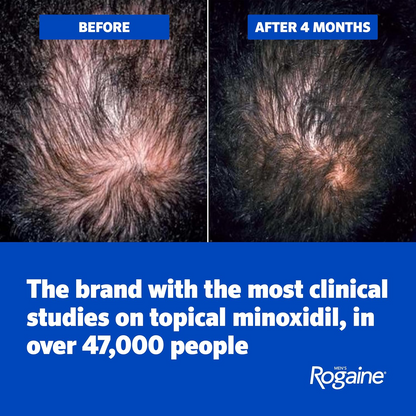 Rogaine Men's Extra Strength 5% Minoxidil Solution