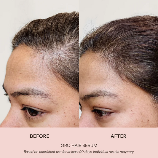 VEGAMOUR GRO Hair Serum