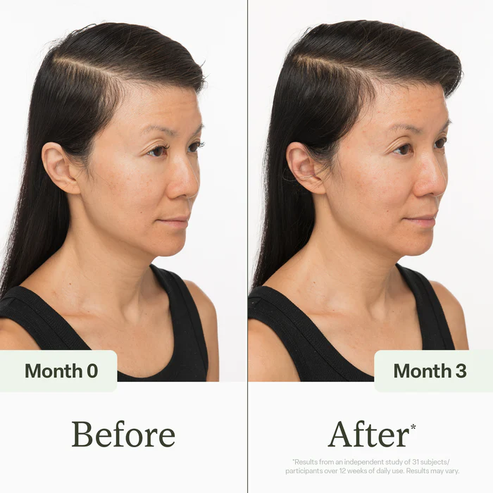 Divi Scalp Serum for Thinning Hair 30ml – 1 Month Supply