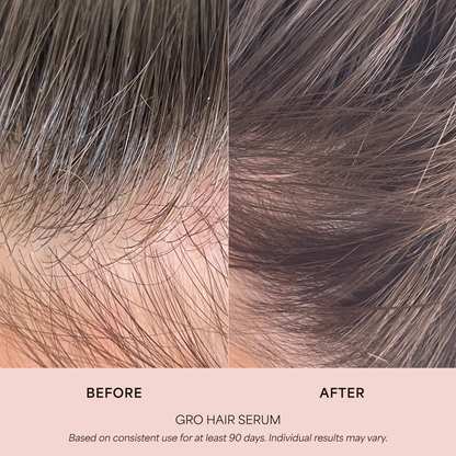 VEGAMOUR GRO Hair Serum