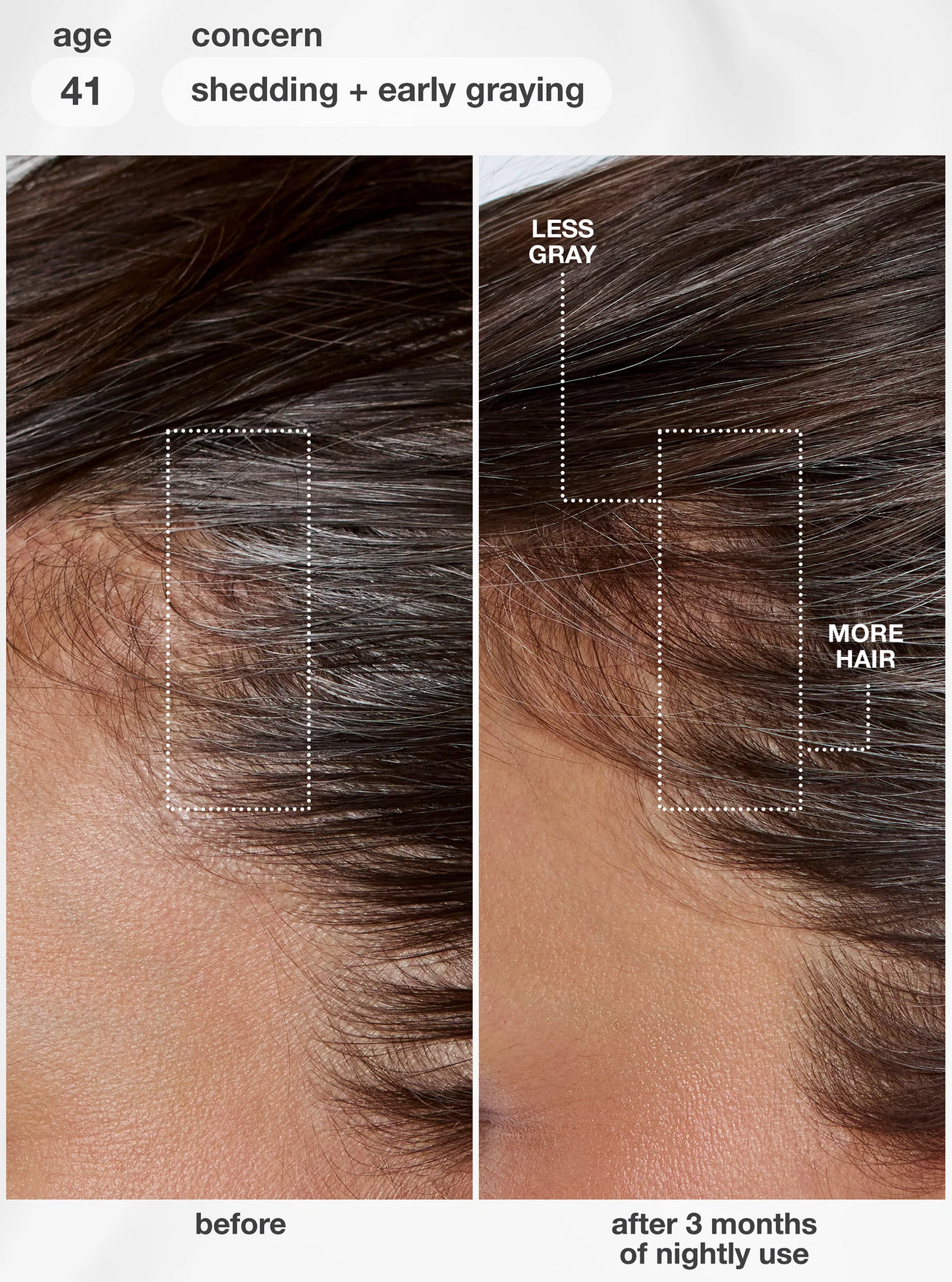 K18 FutureIQ™ Biomimetic Hair Longevity Serum