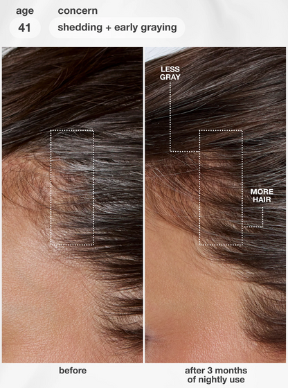 K18 FutureIQ™ Biomimetic Hair Longevity Serum