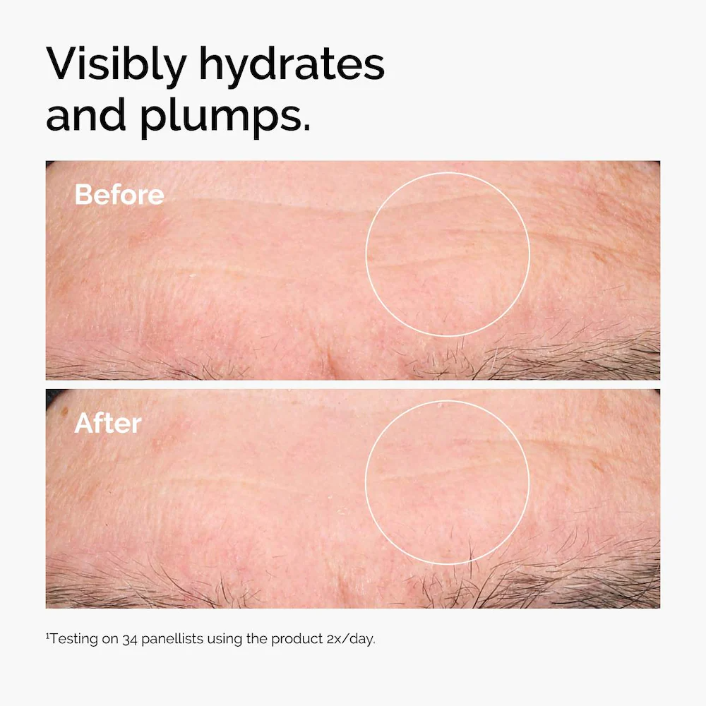 The Ordinary Hyaluronic Acid 2% + B5 Hydrating Serum