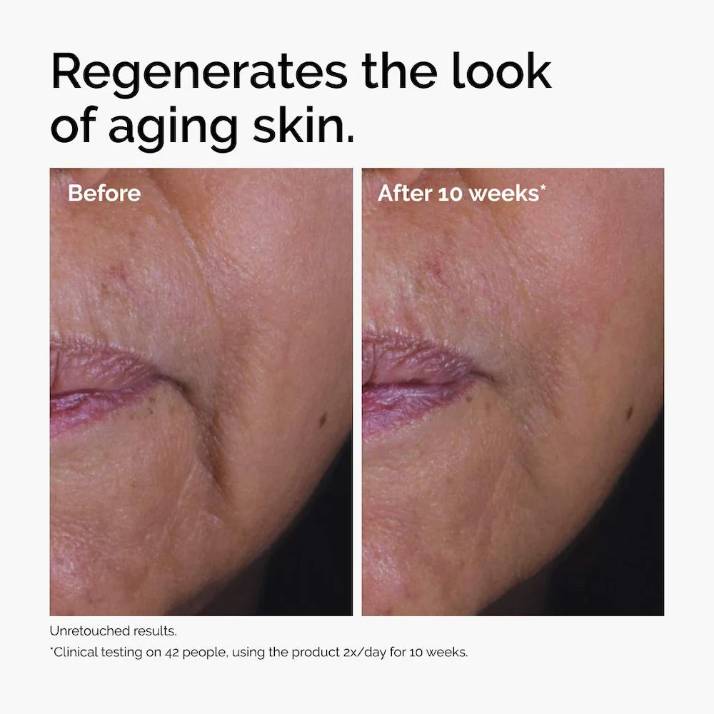 The Ordinary GF 15% Solution Growth Factor Serum