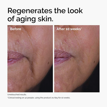 The Ordinary GF 15% Solution Growth Factor Serum
