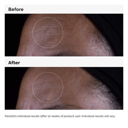 The Ordinary GF 15% Solution Growth Factor Serum