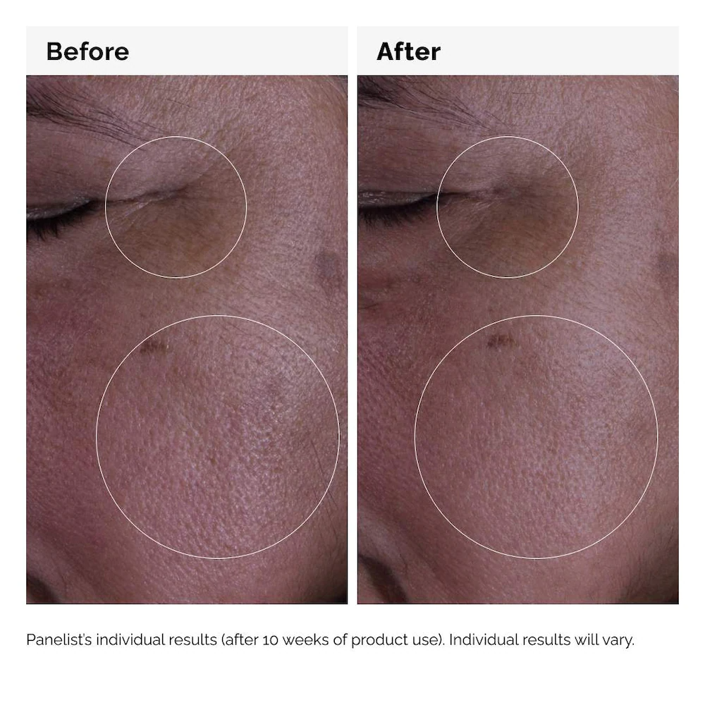 The Ordinary GF 15% Solution Growth Factor Serum