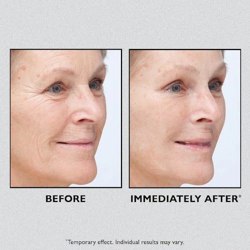 Peter Thomas Roth  Instant FIRMx® Temporary Face Tightener