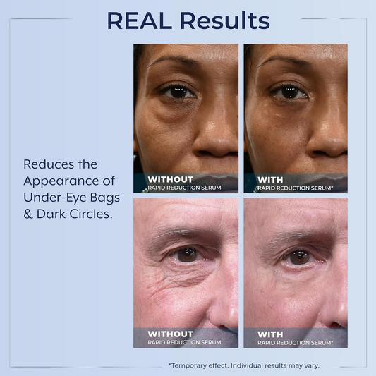 Plexaderm Rapid Reduction Eye Serum - 30 Single Use Pods