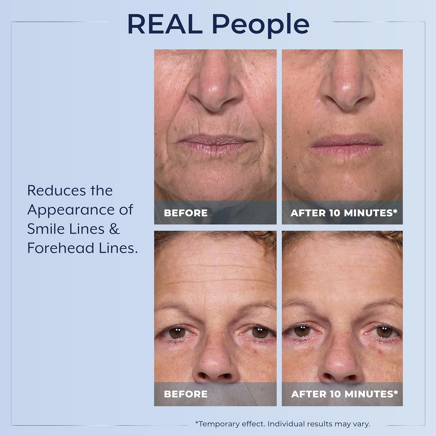 Plexaderm Rapid Reduction Eye Serum