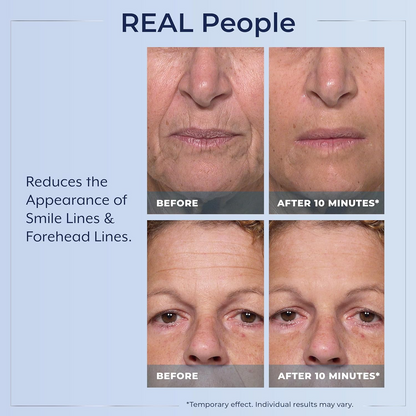 Plexaderm Rapid Reduction Eye Serum