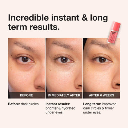 iNNBEAUTY PROJECT  Bright & Tight Dark Circle Firming Eye Cream with Vitamin C & Peptides
