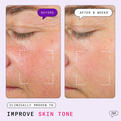 Dr. Idriss  Major Fade Hyper Serum Dark Spot Treatment