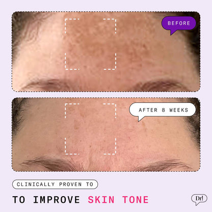 Dr. Idriss  Major Fade Dark Spot Starter Kit