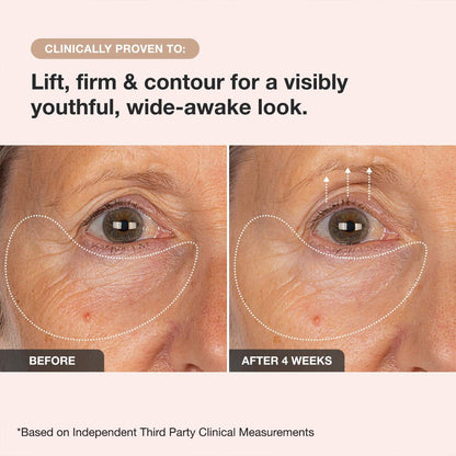 iNNBEAUTY PROJECT  Extreme Cream Eye Firming & Contouring Refillable Eye Cream 15ml
